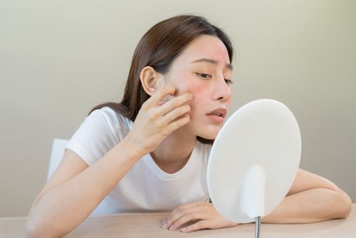 אישה סובלת מעור מגורה בפנים